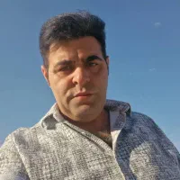 کاشت موی تخصصی تبریز