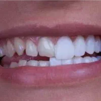 دندانپزشکی اقساطی توضیحات و بخوانید