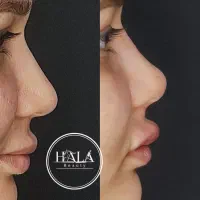 خدمات زیبایی صورت|خدمات آرایشگری و زیبایی|آبادان, |دیوار