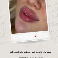 اموزش ویژه ژل و بوتاکس|خدمات آرایشگری و زیبایی|اصفهان, جامی|دیوار