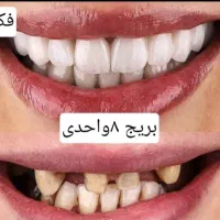 دندانسازی ناب نصف قیمت بازار|پزشکی|شیراز, حجت آباد|دیوار