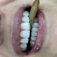 کامپوزیت دندان با ۵۰٪ تخفیف + اقساط ۶ ماهه|خدمات آرایشگری و زیبایی|تهران, محمودیه|دیوار