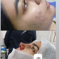 زیبایی|خدمات آرایشگری و زیبایی|دهدشت, |دیوار