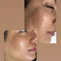 پاکسازی پوست فیشال