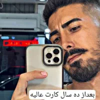 جراحی بینی فقط ۳۵ میلیون