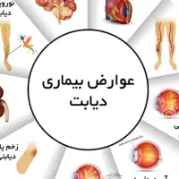 دیابت