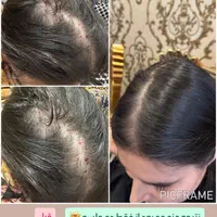 بوتاکس ، فیلر کل صورت ، مزو تراپی ، خال برداری|خدمات آرایشگری و زیبایی|اردبیل, |دیوار