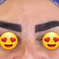 کاشت مو وابروتخصصی|خدمات آرایشگری و زیبایی|خرمشهر, |دیوار