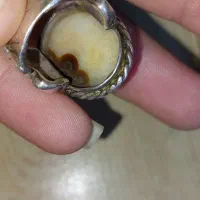 انگشتر رخ|کلکسیون اشیاء عتیقه|کرمان, |دیوار