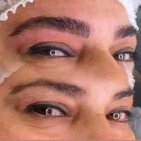 فیبروز ابرو میکرو ابرو