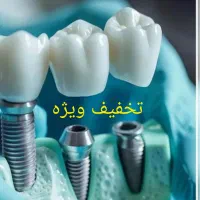 دندانپزشکی ایمپلنت ۹ میلیون و پانصد دندان پزشکی