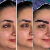 میکروکاشت ابرو با طراحی تخصصی