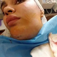 جراحی زیبایی لیپوساکشن لیفت سینه