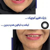 بلک فرایدی دندان مصنوعی دندانسازی اقساط بیمه ها|خدمات آرایشگری و زیبایی|کرمان, |دیوار