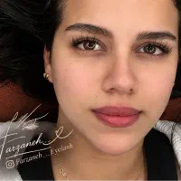 مدل کاشت هیدن مژه در رشت فقط هزینه مواد