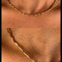 گردنبند چوکر طلا در گالری طلای راز