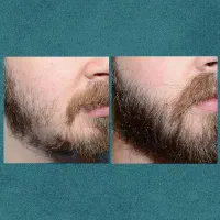 تیغ نزن|آرایشی، بهداشتی، درمانی|یاسوج, |دیوار
