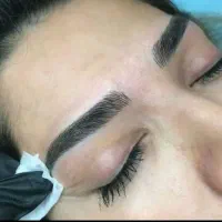 دو مدل برای فیبروز ابرو   (فقط هزینه مواد )