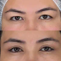 جراحی زیبایی|خدمات آرایشگری و زیبایی|تهران, سازمان برنامه جنوبی|دیوار