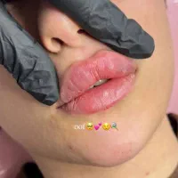 خدمات ژل و بوتاکس با بهترین مواد|خدمات آرایشگری و زیبایی|فسا, |دیوار