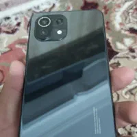 Mi11lite
