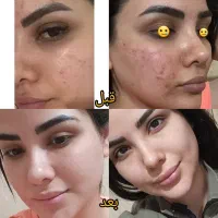 ۵ عدد کرم جوانه گندم اورجینال با قیمت قدیم