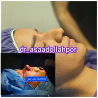 دکتر اسدالله‌پور، جراح برتر بینی در مازندران|خدمات آرایشگری و زیبایی|قائم‌شهر, |دیوار