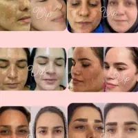 vip|آرایشی، بهداشتی، درمانی|بندرعباس, |دیوار