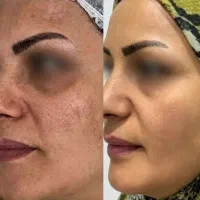 خدمات ناخن، فشیال ،لک، برداشتن خال،رنگ و لایت