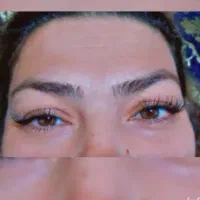 کاشت مژه هیدن