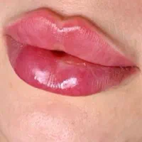هایفوتراپی/هایفو ساکشن  شکم‌ ابدو /بلفاروپلاستی|خدمات آرایشگری و زیبایی|مشهد, وکیل‌آباد|دیوار