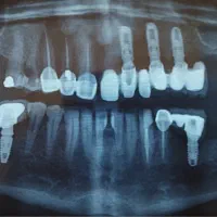 جویای کار دستیار دنداپزشک حراجی