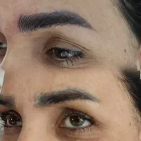 میکروبلیدینگ به روش (هایپر نچرال)