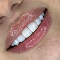 دندانپزشکی کامپوزیت و عصب کشی اقساطی