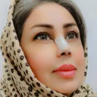 عمل زیبایی بینی 24میلیون|خدمات آرایشگری و زیبایی|قائم‌شهر, |دیوار