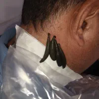 حجامت زالو فصد|آرایشی، بهداشتی، درمانی|یاسوج, |دیوار