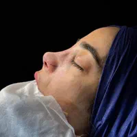 جراحی بینی ۲۴میلیون|خدمات آرایشگری و زیبایی|اسلامشهر, شهرک قائمیه|دیوار