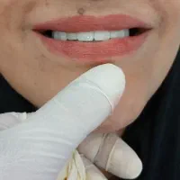 کلینیک تخصصی ایمپلنت با اقساط بلندمدت|خدمات آرایشگری و زیبایی|تهران, قیطریه|دیوار