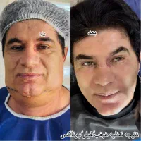 تزریق ژل و بوتاکس-چربی|خدمات آرایشگری و زیبایی|اهواز, کیانپارس |دیوار
