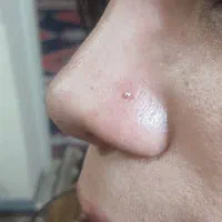 پرسینگ|خدمات زیبایی و سلامت|زرقان, |دیوار
