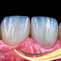 لمینیت لب شیشه قسطی کامپوزیت بلیچینگ دندان|خدمات آرایشگری و زیبایی|مشهد, سجاد شهر|دیوار