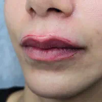 مدل جهت ریمو تتوهای قدیمی و بد رنگ|خدمات آرایشگری و زیبایی|تهران, سعادت‌آباد|دیوار