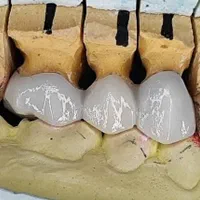 خانم با استعداد و پشتکار جهت آموزش دندان سازی