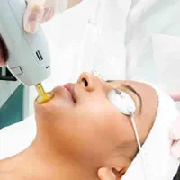 لیزر موی زائد|خدمات آرایشگری و زیبایی|یاسوج, |دیوار