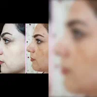 کرم تضمینی صورت معجزه|آرایشی، بهداشتی، درمانی|خاش, |دیوار