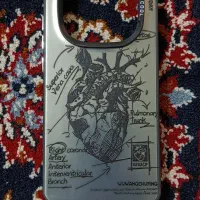 گارد گوشی نوت چهارده پرو فورجی