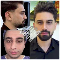 جراحی عمل بینی لیپو ابدو لیفت پروتز پیکرتراشی|خدمات آرایشگری و زیبایی|تهران, تهران پارس|دیوار