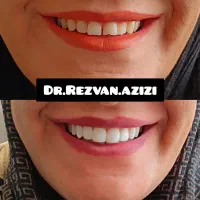 جشنواره بزرگ عصبکشی دندان برای اولین بار|خدمات آرایشگری و زیبایی|شیراز, سینما سعدی|دیوار