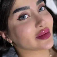 تخفیفات خدمات فیلر و بوتاکس کلینیک