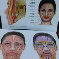 آموزش فشیال طب سنتی فیلر ژل بوتاکس نخ لیفت لیزر مو|خدمات آموزشی|اصفهان, باغ زرشک|دیوار